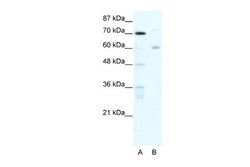 FOXJ2 Antibody, Novus Biologicals 100 &mu;L | Buy Online | Novus Biologicals | Fisher Scientific